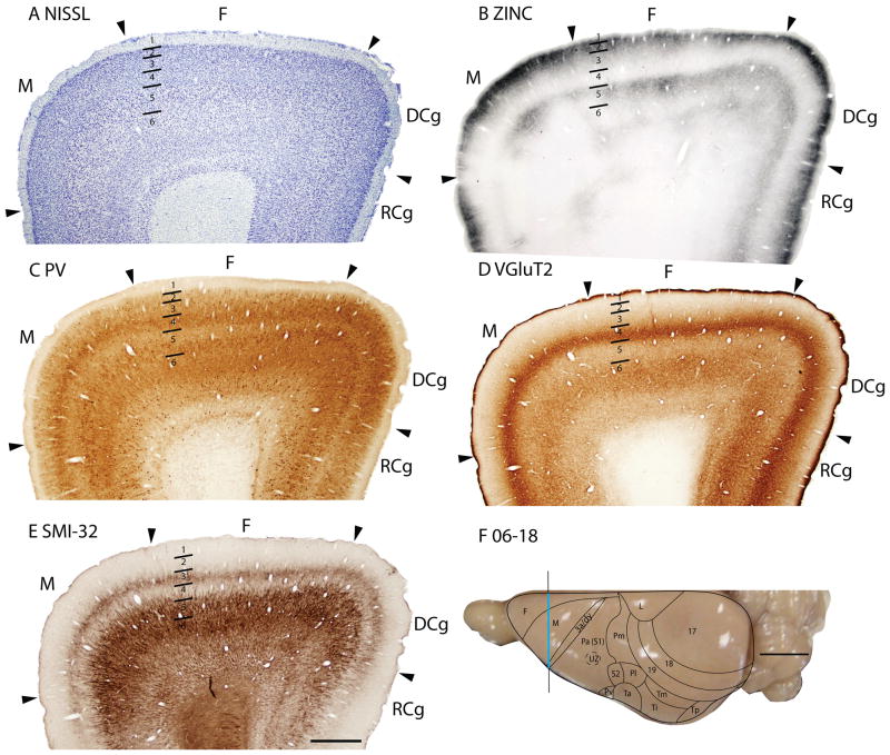 Figure 16