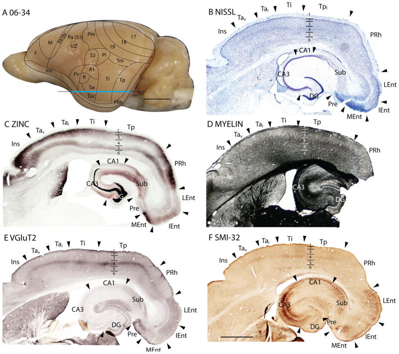 Figure 19