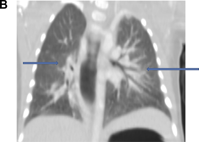 Fig. 2b