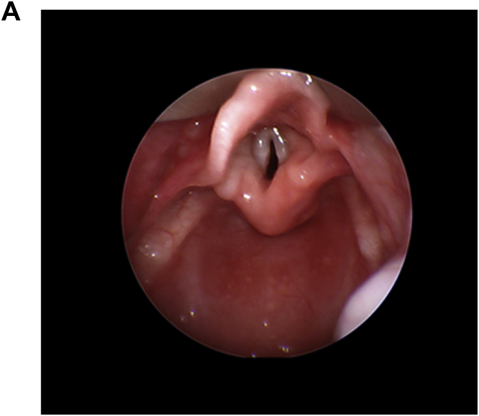 Fig. 3a