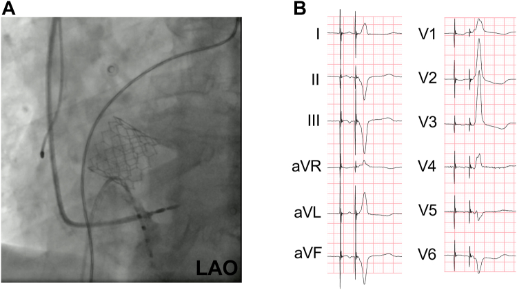 Figure 3