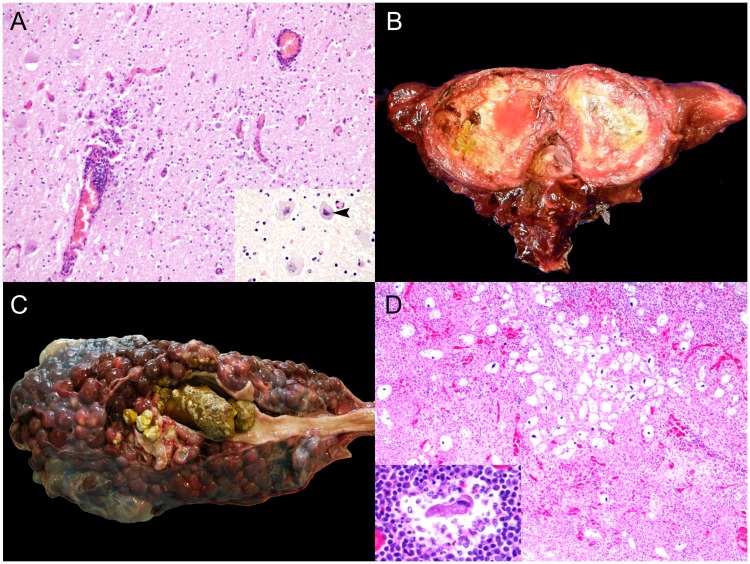 Fig 2