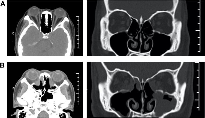 Fig. 5