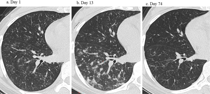 Figure 3.