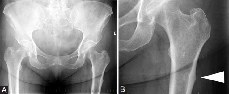 Figure 3 (A, B)