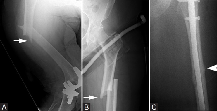 Figure 2 (A-C)