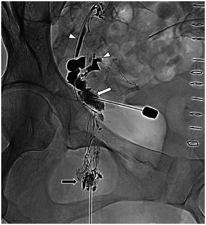 Fig. 14