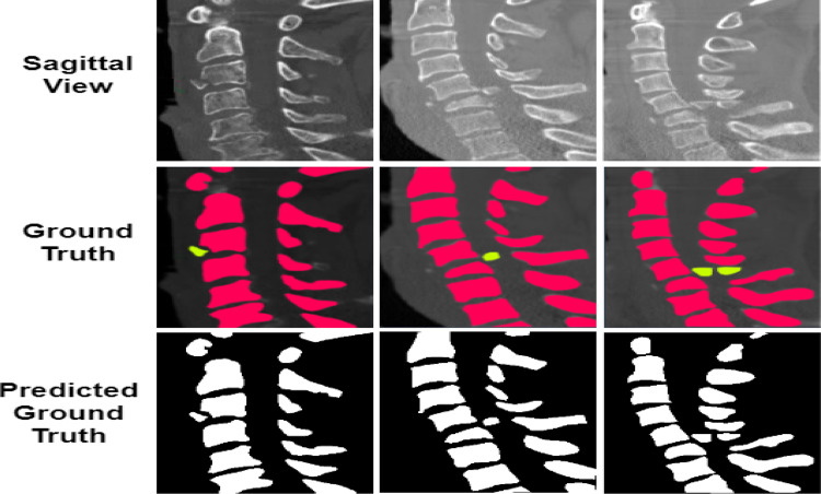 Fig. 11