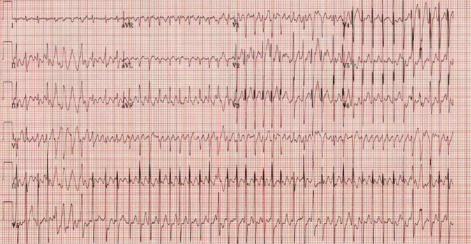 Fig. 3