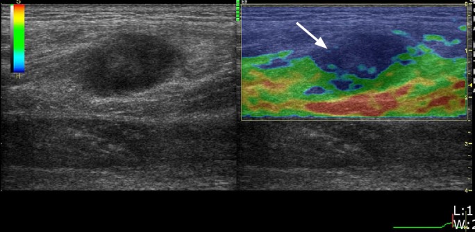 Fig. 6.