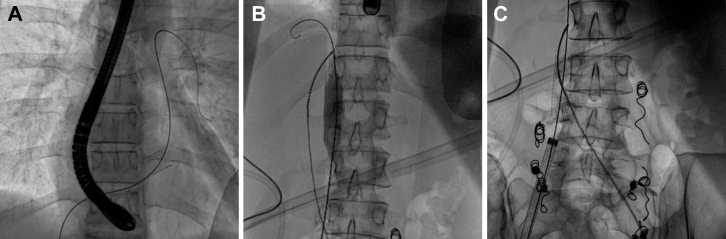 Fig 3