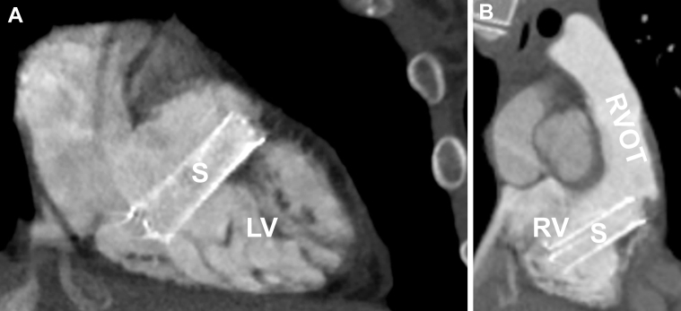 Fig 2