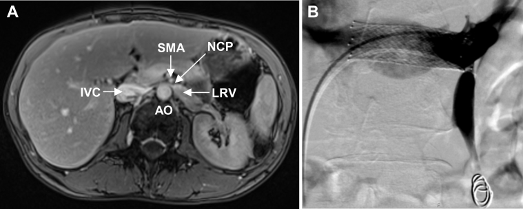 Fig 1