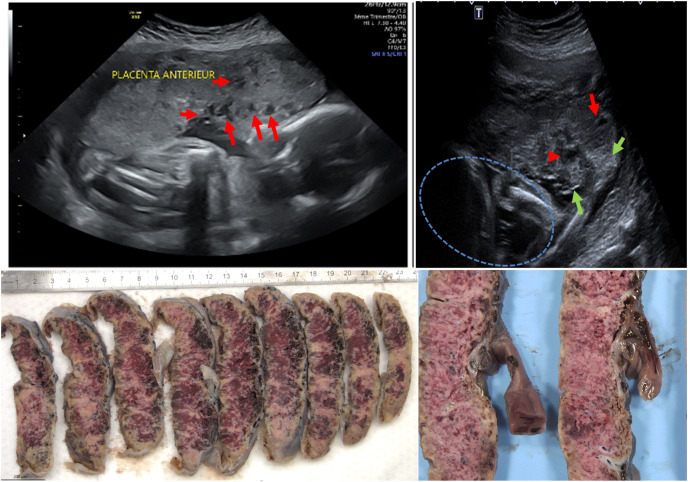 Fig. 1