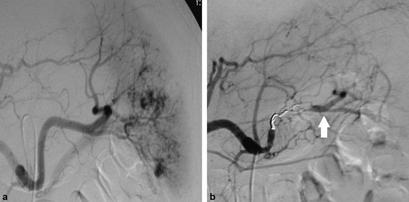 Fig. 16