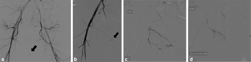 Fig. 20