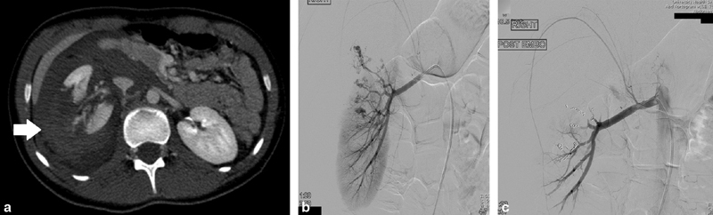 Fig. 18