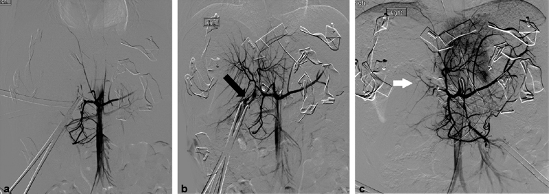 Fig. 14