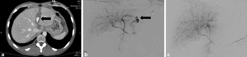 Fig. 13