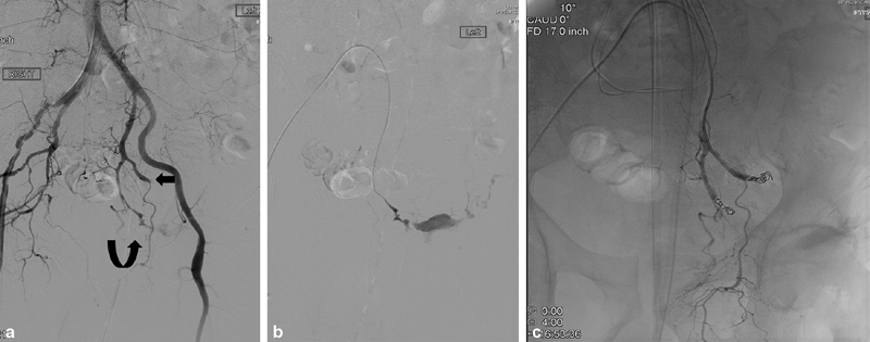 Fig. 19