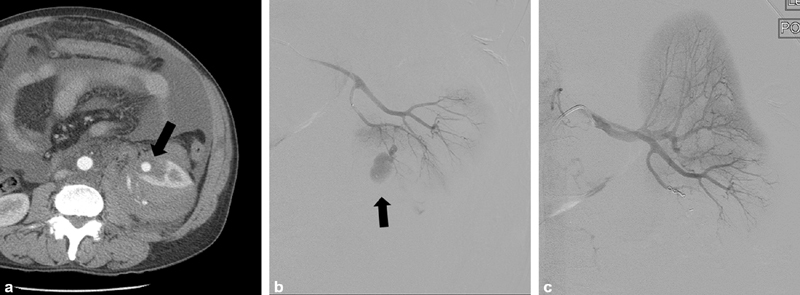 Fig. 17