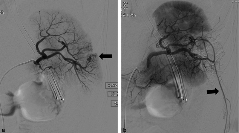 Fig. 15