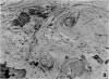 266-1