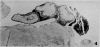 266-1