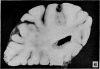 266-2