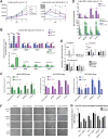 Figure 3. JAZF1 overexpression confers resistance to polyamine-targeted therapies. A, JAZF1 overexpression leads to increased growth over 8 days for androgen sensitive (LNCaP) and insensitive (C4–2 and RV1) cell lines without (left) and with (right) combination therapy. B, Overexpression of JAZF1 resulted in alterations of genes associated with response to treatment such as decreases n SSAT (target of BENSpm) and SMOX and PAOX (ROS producers) in both androgen-independent (blue and purple, top) and dependent (green, bottom) cell lines. C, Basal levels of ROS and ROS induction with treatment are decreased with JAZF1 overexpression as compared with parental controls in both LNCaP C4–2 (blue, top) and LNCaP (green, bottom) cell lines (D) Both basal and combination treated SSAT activity is reduced across all cell lines with JAZF1 overexpression as compared with parental controls. E, UPLC analysis of intracellular spermine and spermidine pools after 8 days of treatment indicates that the BENSPm and combination therapy induced distortion of the spermidine/spermine ratio abrogated with JAZF1 overexpression. F, Representative images of colony formation with combination therapy in the parental cell lines (−JAZF1) and JAZF1 overexpression (+JAZF1) cell lines, quantitated by CV. G, CV quantification at day 25 of the colony formation assay comparing the ratio of absorbance present in the combination/vehicle treated groups for each of the parental and JAZF1 overexpressing cell lines, multiple t tests were performed to assess significance in the ratio between parental controls and the JAZF1 overexpressing cell lines. *All experiments were a biological n = 3 and represent mean ± SD Significance calculated by Student t test, unless otherwise indicated.