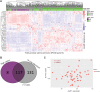 Figure 5. Increased JAZF1 corresponds with decreased predicted sensitivity to combination therapy. A, Unsupervised hierarchical clustering of transcriptomic data from TCGA PRAD patients stratified into JAZF1 expression high, top 25% (purple) and low, lower 75% (green) and ex vivo score predicted resistant, top 50% (gray) and predicted sensitive, lower 50% (green) based upon the 82-gene ex vivo signature genes. B, Venn diagram demonstrates a significant overlap of the patients with increased levels of JAZF1 (purple) and predicted resistance to polyamine therapies by ex vivo score (gray). Significance determined by hypergeometric test. C, JAZF1 and ex vivo prediction scores were positively correlated in the metastatic samples of the Taylor and colleagues dataset.