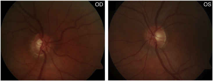 Fig. 4