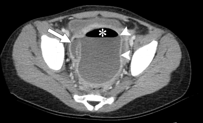 Figure 3b.