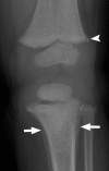 Figure 2a.