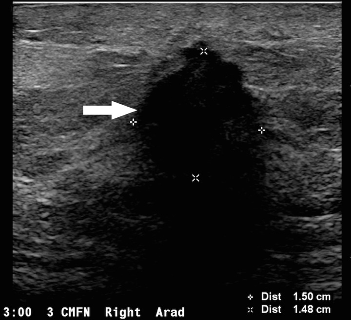 Figure 4e.