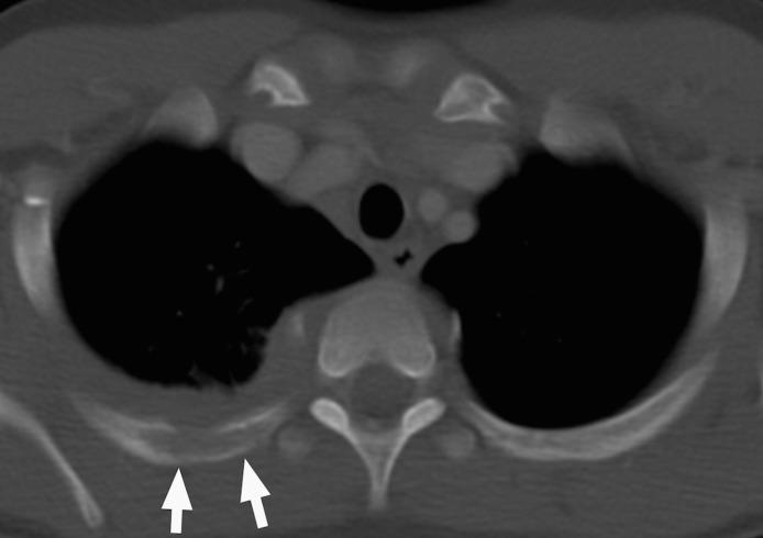 Figure 6b.