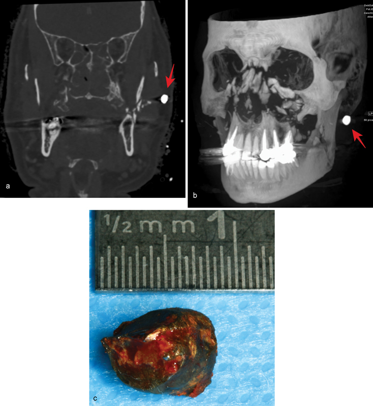 Fig. 9