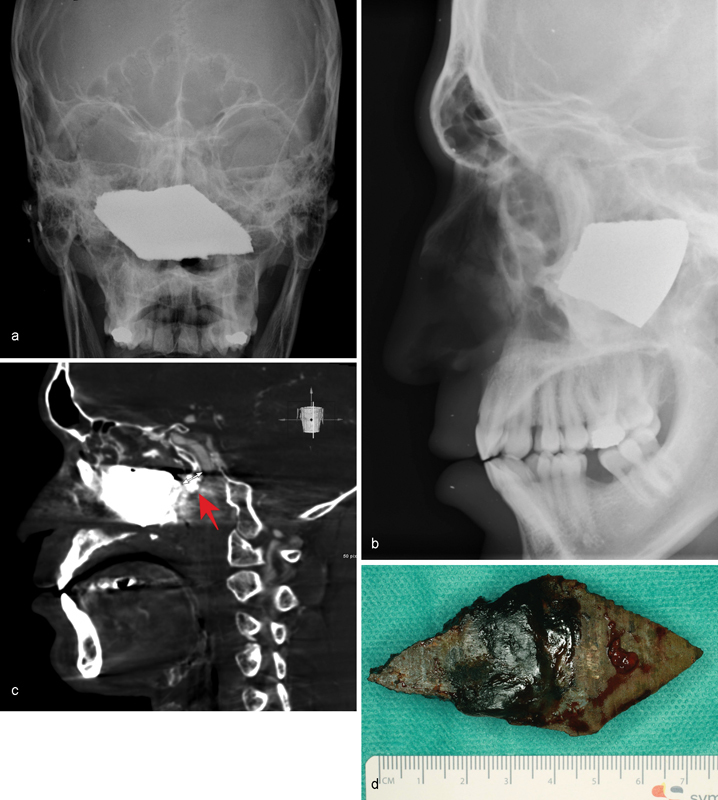 Fig. 8