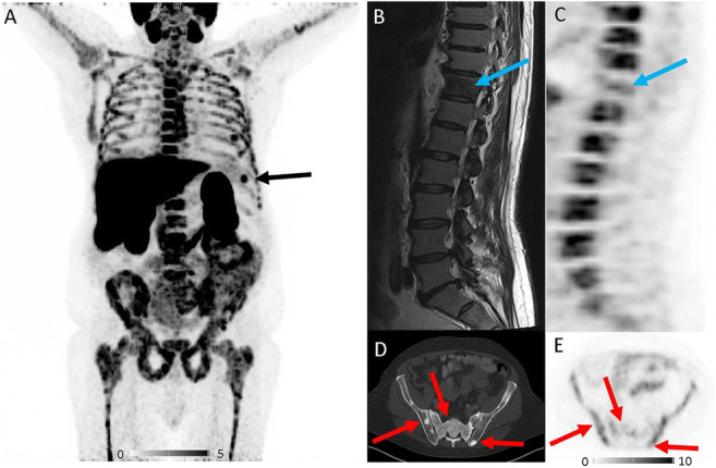 graphic file with name 259_2020_5072_Figa_HTML.jpg