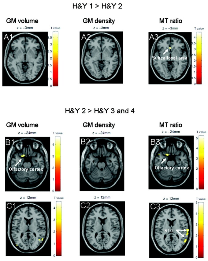 Fig 3.