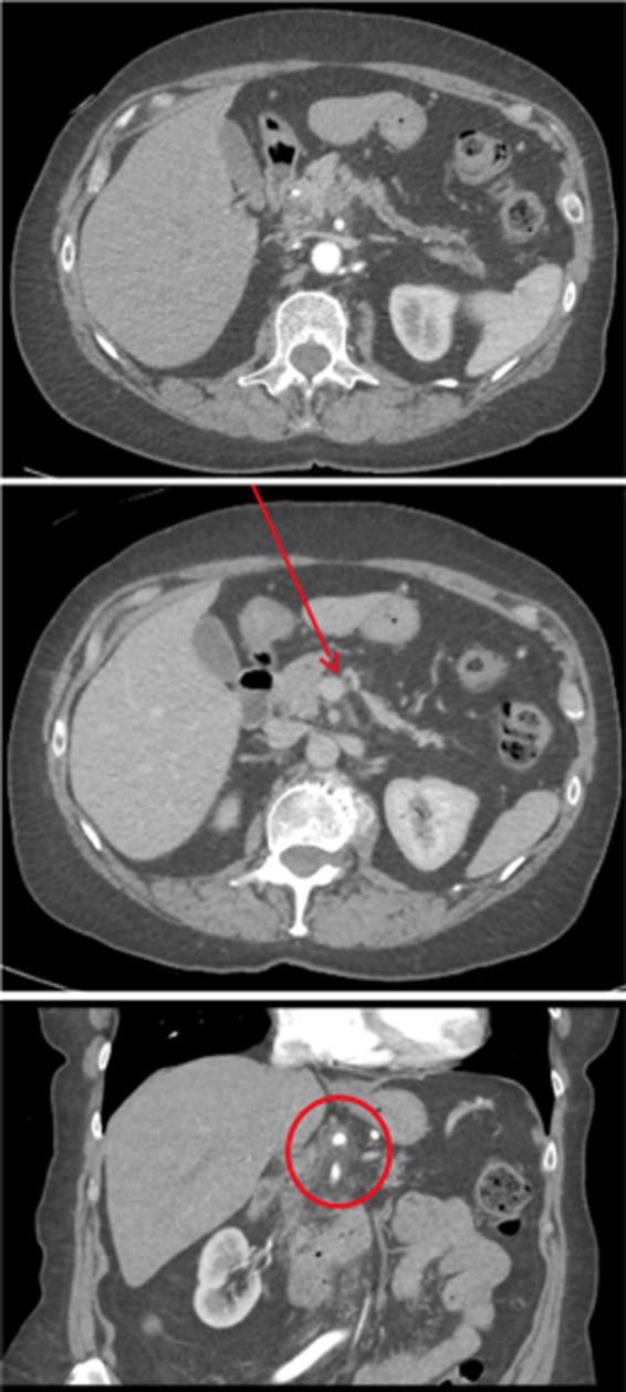 FIG. 2.