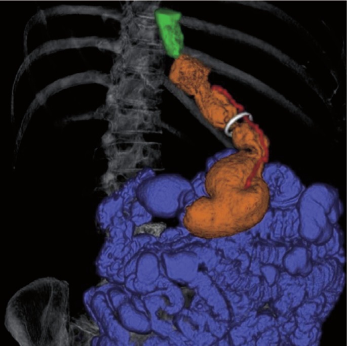 Fig. 2