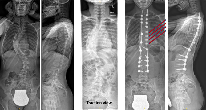 Fig. 3