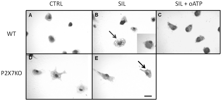 Figure 14