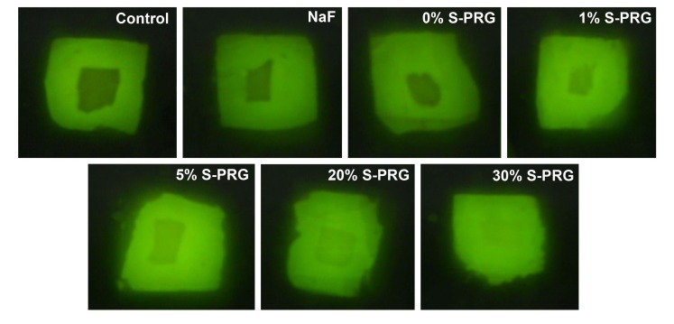 Fig. (1)