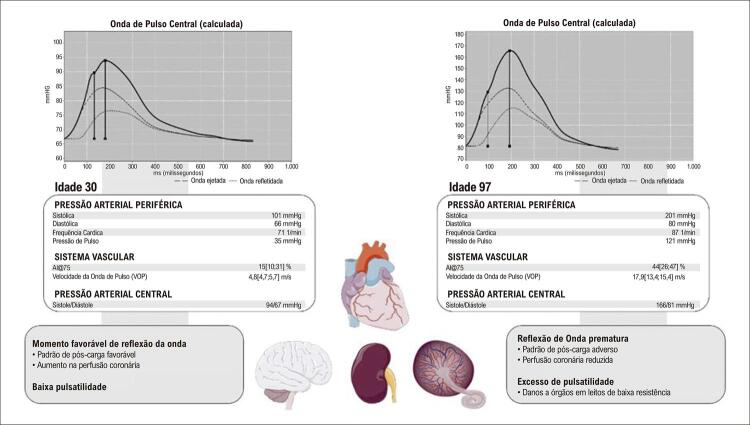 Figura 1