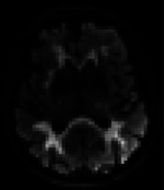 graphic file with name nihpp-rs6254029v1-t0004.jpg