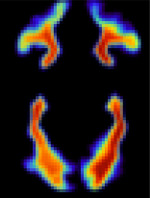 graphic file with name nihpp-rs6254029v1-t0005.jpg