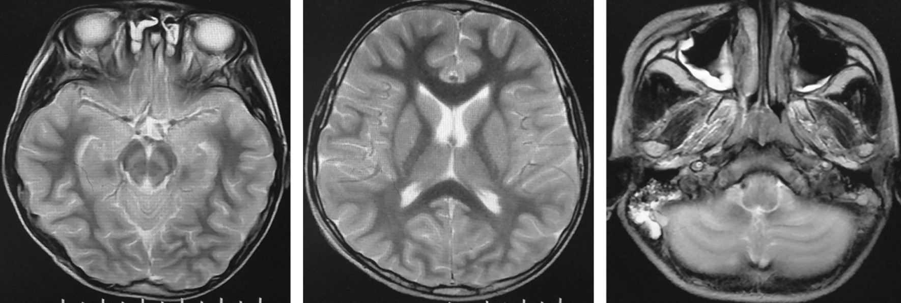 Fig. 2