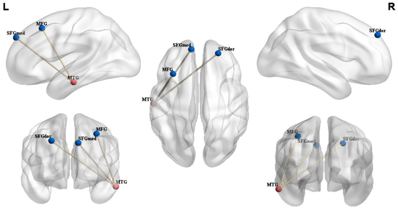 FIGURE 3